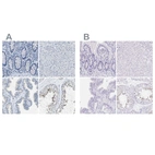 Immunohistochemical staining of human colon, liver, prostate and testis using Anti-EQTN antibody HPA015089 (A) shows similar protein distribution across tissues to independent antibody HPA015504 (B).