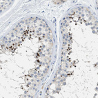 Immunohistochemical staining of human testis shows strong positivity in cells in seminiferous ducts.