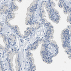 Immunohistochemical staining of human prostate shows no positivity in glandular cells as expected.