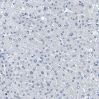 Immunohistochemical staining of human liver shows no positivity in hepatocytes as expected.
