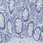 Immunohistochemical staining of human colon shows no positivity in glandular cells as expected.