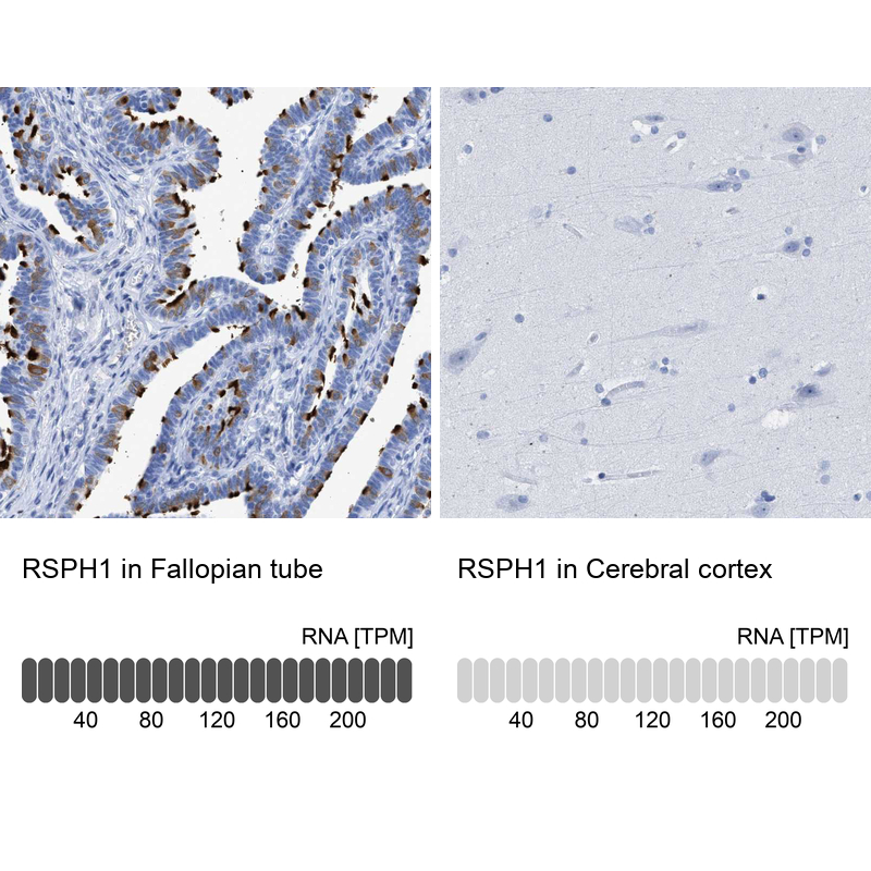 Anti-RSPH1 Antibody