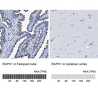 Anti-RSPH1 Antibody