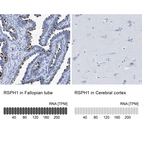 Anti-RSPH1 Antibody
