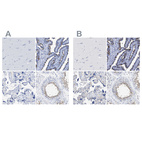 Immunohistochemical staining of human cerebral cortex, fallopian tube, placenta and testis using Anti-RSPH1 antibody HPA016816 (A) shows similar protein distribution across tissues to independent antibody HPA017382 (B).