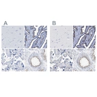 Immunohistochemical staining of human cerebral cortex, fallopian tube, placenta and testis using Anti-RSPH1 antibody HPA016816 (A) shows similar protein distribution across tissues to independent antibody HPA017382 (B).