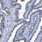Immunohistochemical staining of human Fallopian tube shows strong positivity in cilia in glandular cells.