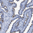 Immunohistochemical staining of human Fallopian tube shows strong positivity in cilia in glandular cells.