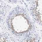 Immunohistochemical staining of human testis shows moderate cytoplasmic positivity in cells in seminiferous ducts.