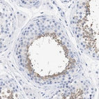 Immunohistochemical staining of human testis shows moderate cytoplasmic positivity in cells in seminiferous ducts.