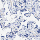Immunohistochemical staining of human placenta shows no positivity in trophoblastic cells as expected.