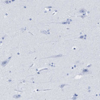Immunohistochemical staining of human cerebral cortex shows no positivity in neurons as expected.