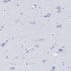 Immunohistochemical staining of human cerebral cortex shows no positivity in neurons as expected.