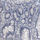 Immunohistochemical staining of human duodenum shows no positivity in glandular cells as expected.