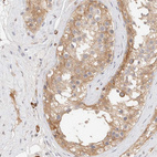 Immunohistochemical staining of human testis shows moderate cytoplasmic positivity in cells in seminiferous ducts.