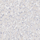 Immunohistochemical staining of human liver shows no cytoplasmic positivity in hepatocytes as expected.