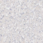 Immunohistochemical staining of human liver shows no cytoplasmic positivity in hepatocytes as expected.