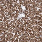 Immunohistochemical staining of human liver shows strong granular cytoplasmic positivity in hepatocytes.