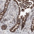 Immunohistochemical staining of human colon shows strong granular cytoplasmic positivity in glandular cells.
