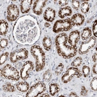 Immunohistochemical staining of human kidney shows strong granular cytoplasmic positivity in cells in tubules.