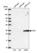 Western blot analysis in U2OS cells transfected with control siRNA, target specific siRNA probe #1 and #2, using Anti-ETFA antibody. Remaining relative intensity is presented.