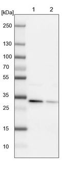 Lane 1: NIH-3T3 cell lysate (Mouse embryonic fibroblast cells)_br/_Lane 2: NBT-II cell lysate (Rat Wistar bladder tumour cells)