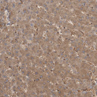 Immunohistochemical staining of human liver shows moderate cytoplasmic positivity in hepatocytes.