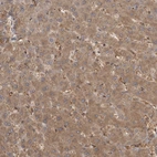Immunohistochemical staining of human liver shows moderate cytoplasmic positivity in hepatocytes.