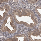 Immunohistochemical staining of human endometrium shows moderate cytoplasmic positivity in glandular cells.
