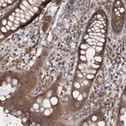 Immunohistochemical staining of human rectum shows moderate cytoplasmic positivity in glandular cells.