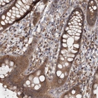 Immunohistochemical staining of human rectum shows moderate cytoplasmic positivity in glandular cells.