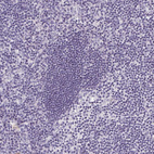 Anti-GSDMC Antibody
