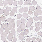Immunohistochemical staining of human skeletal muscle shows no positivity in myocytes as expected.