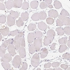 Immunohistochemical staining of human skeletal muscle shows no positivity in myocytes as expected.