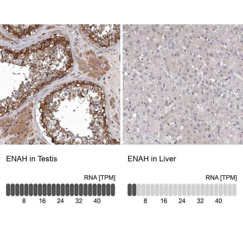 Anti-ENAH Antibody