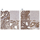 Immunohistochemical staining of human fallopian tube, liver, prostate and testis using Anti-ENAH antibody HPA028696 (A) shows similar protein distribution across tissues to independent antibody HPA028448 (B).