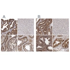 Immunohistochemical staining of human fallopian tube, liver, prostate and testis using Anti-ENAH antibody HPA028696 (A) shows similar protein distribution across tissues to independent antibody HPA028448 (B).