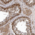 Immunohistochemical staining of human testis shows strong cytoplasmic positivity in cells in seminiferous ducts.