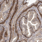 Immunohistochemical staining of human prostate shows moderate to strong cytoplasmic and membranous positivity in glandular cells and smooth muscle cells.
