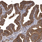 Immunohistochemical staining of human Fallopian tube shows strong cytoplasmic and membranous positivity in glandular cells.