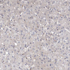 Immunohistochemical staining of human liver shows low positivity in hepatocytes as expected.