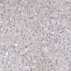 Immunohistochemical staining of human liver shows low positivity in hepatocytes as expected.