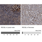 Anti-RECQL Antibody