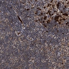 Immunohistochemical staining of human lymph node shows high expression.