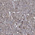 Immunohistochemical staining of human pancreas shows low expression as expected.