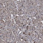 Anti-RECQL Antibody