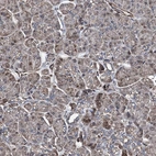 Immunohistochemical staining of human pancreas shows low expression as expected.