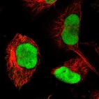 Immunofluorescent staining of human cell line U-251 MG shows localization to nucleoplasm.