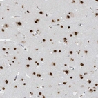 Immunohistochemical staining of human cerebral cortex shows strong nuclear positivity in neuronal cells.
