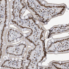 Immunohistochemical staining of human duodenum shows strong nuclear positivity in glandular cells.
